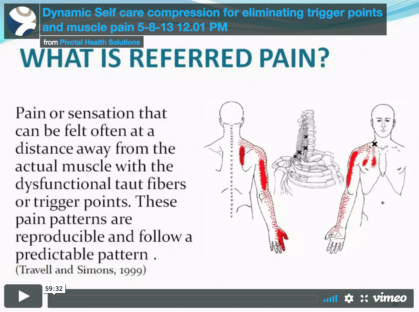 Trigger Points